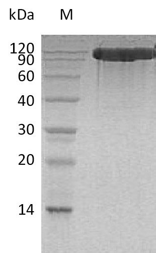 Greater than 95% as determined by SDS-PAGE.Recombinant Human Angiotensin-Converting Enzyme 2 (ACE2) Protein (His), Active