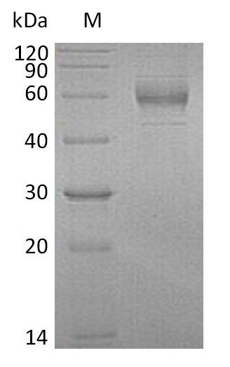 Greater than 90% as determined by SDS-PAGE.Recombinant Human Gdnf Family Receptor Alpha-1 (GFRA1) Protein (His), Active