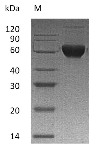 Greater than 95% as determined by SDS-PAGE.Recombinant Human Activin Receptor Type-2B (ACVR2B) Protein (His-hFc), Active