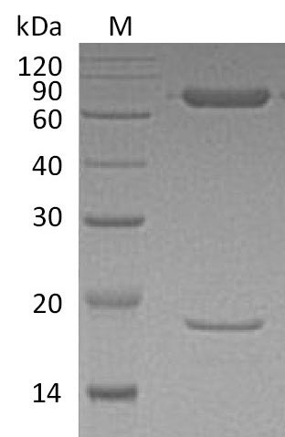 Greater than 95% as determined by SDS-PAGE.Recombinant Human Proprotein Convertase Subtilisin/Kexin Type 9 (PCSK9) Protein (Avi), Active