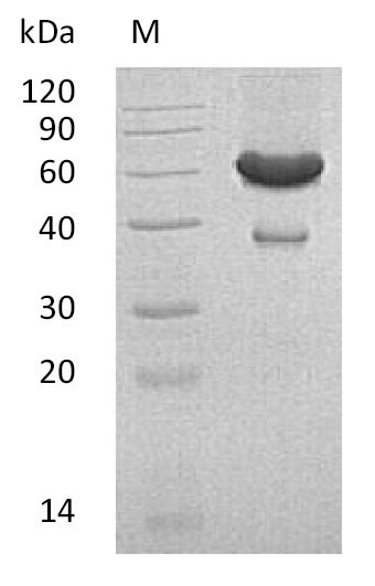 Greater than 90% as determined by SDS-PAGE.Recombinant Mouse Ephrin-A1 (EFNA1) Protein (His-hFc), Active