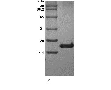 Greater than 98% as determined by SDS-PAGE.Recombinant Human Interleukin-21 (IL21), Active, GMP