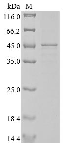 Greater than 85% as determined by SDS-PAGE.Recombinant Human Actin, Cytoplasmic 1 (ACTB) Protein (His&Myc)