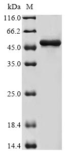 Greater than 85% as determined by SDS-PAGE.Recombinant Human Actin-Related Protein 3 (ACTR3) Protein (His&Myc)