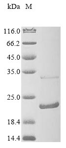 Greater than 85% as determined by SDS-PAGE.Recombinant Mouse Anterior Gradient Protein 2 Homolog (AGR2) Protein (His&Myc)
