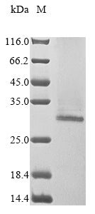 Greater than 85% as determined by SDS-PAGE.Recombinant Human Single-Stranded Dna Cytosine Deaminase (AICDA) Protein (His&Myc)
