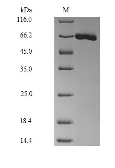 Greater than 85% as determined by SDS-PAGE.Recombinant Mouse Serum Albumin (ALB) Protein (His)