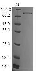 Greater than 90% as determined by SDS-PAGE.Recombinant Human Tyrosine-Protein Kinase Btk (BTK) Protein (His)