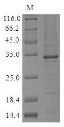 Greater than 85% as determined by SDS-PAGE.Recombinant Human Complement C1Q Subcomponent Subunit A (C1QA) Protein (His&Myc)