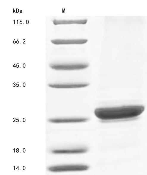 Greater than 85% as determined by SDS-PAGE.Recombinant Human Complement Component C8 Gamma Chain (C8G) Protein (His)