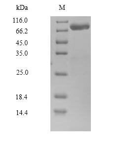 Greater than 90% as determined by SDS-PAGE.Recombinant Human Calpain-14 (CAPN14) Protein (His&Myc)