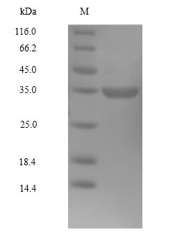 Greater than 90% as determined by SDS-PAGE.Recombinant Human Cyclin-Dependent Kinase4 (CDK4) Protein (His)