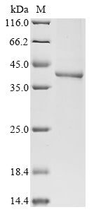 Greater than 85% as determined by SDS-PAGE.Recombinant Human Cyclin-Dependent Kinase 7 (CDK7) Protein (His)