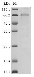 Greater than 85% as determined by SDS-PAGE.Recombinant Human Liver Carboxylesterase 1 (CES1) Protein (His)