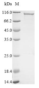 Greater than 85% as determined by SDS-PAGE.Recombinant Human Cartilage Intermediate Layer Protein 1 (CILP) Protein (MBP&His)