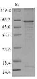 Greater than 85% as determined by SDS-PAGE.Recombinant Human Cathepsin O (CTSO) Protein (MBP&His)