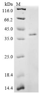 Greater than 85% as determined by SDS-PAGE.Recombinant Mouse Ccn Family Member 1 (CCN1) Protein (His)