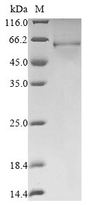 Greater than 85% as determined by SDS-PAGE.Recombinant Human Protein Dek (DEK) Protein (His&Myc)