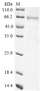 Greater than 85% as determined by SDS-PAGE.Recombinant Mouse Desmoglein-3 (DSG3) Protein (His)