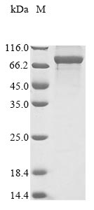 Greater than 85% as determined by SDS-PAGE.Recombinant Human Cytoplasmic Dynein 1 Intermediate Chain 1 (DYNC1I1) Protein (His)