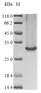 Greater than 85% as determined by SDS-PAGE.Recombinant Human Gamma-Aminobutyric Acid Receptor Subunit Beta-2 (GABRB2) Protein (His)