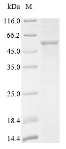 Greater than 85% as determined by SDS-PAGE.Recombinant Human Lysosomal Acid Glucosylceramidase (GBA1) Protein (His)