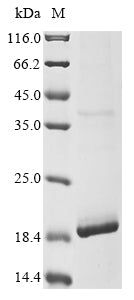 Greater than 85% as determined by SDS-PAGE.Recombinant Human Glucagon Receptor (GCGR) Protein (His&My/His/Tag-Free)