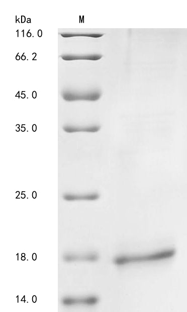 Greater than 85% as determined by SDS-PAGE.Recombinant Human Gastric Inhibitory Polypeptide Receptor (GIPR) Protein (His&Myc)