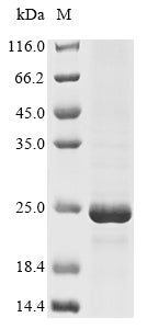 Greater than 85% as determined by SDS-PAGE.Recombinant Mouse Gap Junction Alpha-1 Protein (GJA1) Protein (His&Myc)