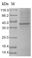 Greater than 85% as determined by SDS-PAGE.Recombinant Human Heat-Stable Enterotoxin Receptor (GUCY2C) Protein (His)