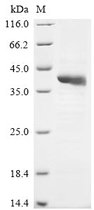 Greater than 85% as determined by SDS-PAGE.Recombinant Human Hyaluronan And Proteoglycan Link Protein 3 (HAPLN3) Protein (His)
