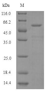 Greater than 90% as determined by SDS-PAGE.Recombinant Human Histidine--Trna Ligase, Cytoplasmic (HARS1) Protein (His)