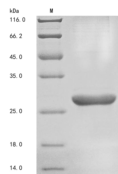 Greater than 85% as determined by SDS-PAGE.Recombinant Human Basement Membrane-Specific Heparan Sulfate Proteoglycan Core Protein (HSPG2) Protein (His&Myc)