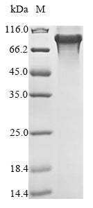 Greater than 85% as determined by SDS-PAGE.Recombinant Human Inhibitor Of Nuclear Factor Kappa-B Kinase Subunit Beta (IKBKB) Protein (His)