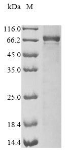 Greater than 85% as determined by SDS-PAGE.Recombinant Mouse Interleukin-1 Receptor-Associated Kinase 3 (IRAK3) Protein (His&Myc)