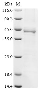 Recombinant Human Transcription Factor Jun (JUN) Protein (His) | Beta ...
