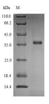 Greater than 90% as determined by SDS-PAGE.Recombinant Human L-Lactate Dehydrogenase C Chain (LDHC) Protein (His)