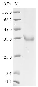 Greater than 90% as determined by SDS-PAGE.