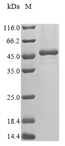 Greater than 85% as determined by SDS-PAGE.Recombinant Human Melanoma-Associated Antigen B2 (MAGEB2) Protein (His&Myc)