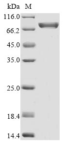 Greater than 85% as determined by SDS-PAGE.Recombinant Human Mannan-Binding Lectin Serine Protease 2 (MASP2) Protein (His)