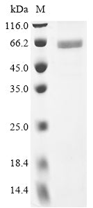 Greater than 90% as determined by SDS-PAGE.Recombinant Human N-Myc Proto-Oncogene Protein (MYCN) Protein (His)