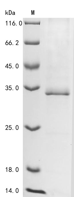 Greater than 85% as determined by SDS-PAGE.Recombinant Mouse Myocilin (MYOC) Protein (His&Myc)