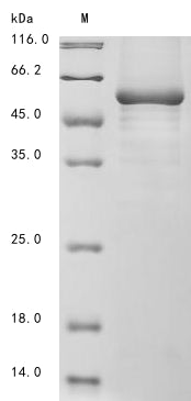 Greater than 85% as determined by SDS-PAGE.Recombinant Mouse Neuronal Pentraxin Receptor (NPTXR) Protein (His&Myc)