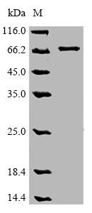 Greater than 85% as determined by SDS-PAGE.Recombinant Human Optineurin (OPTN) Protein (His)