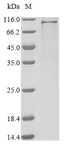 Greater than 85% as determined by SDS-PAGE.Recombinant Human Plasminogen (PLG) Protein (His&Myc)