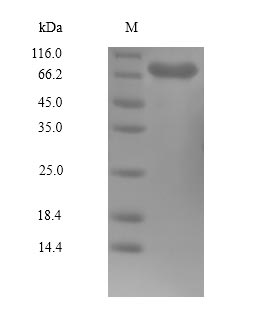 Greater than 90% as determined by SDS-PAGE.Recombinant Human Serine/Threonine-Protein Kinase Plk1 (PLK1) Protein (His)
