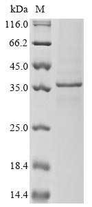 Greater than 85% as determined by SDS-PAGE.Recombinant Mouse Receptor-Type Tyrosine-Protein Phosphatase S (PTPRS) Protein (His&Myc)