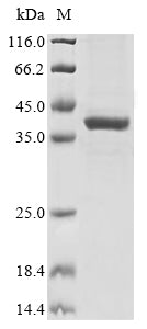 Greater than 85% as determined by SDS-PAGE.Recombinant Human Glutaminyl-Peptide Cyclotransferase (QPCT) Protein (His&Myc)