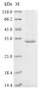 Greater than 85% as determined by SDS-PAGE.Recombinant Mouse Dexamethasone-Induced Ras-Related Protein 1 (RASD1) Protein (His)