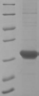 Greater than 90% as determined by SDS-PAGE.Recombinant Human Recoverin (RCVRN) Protein (His&Myc)